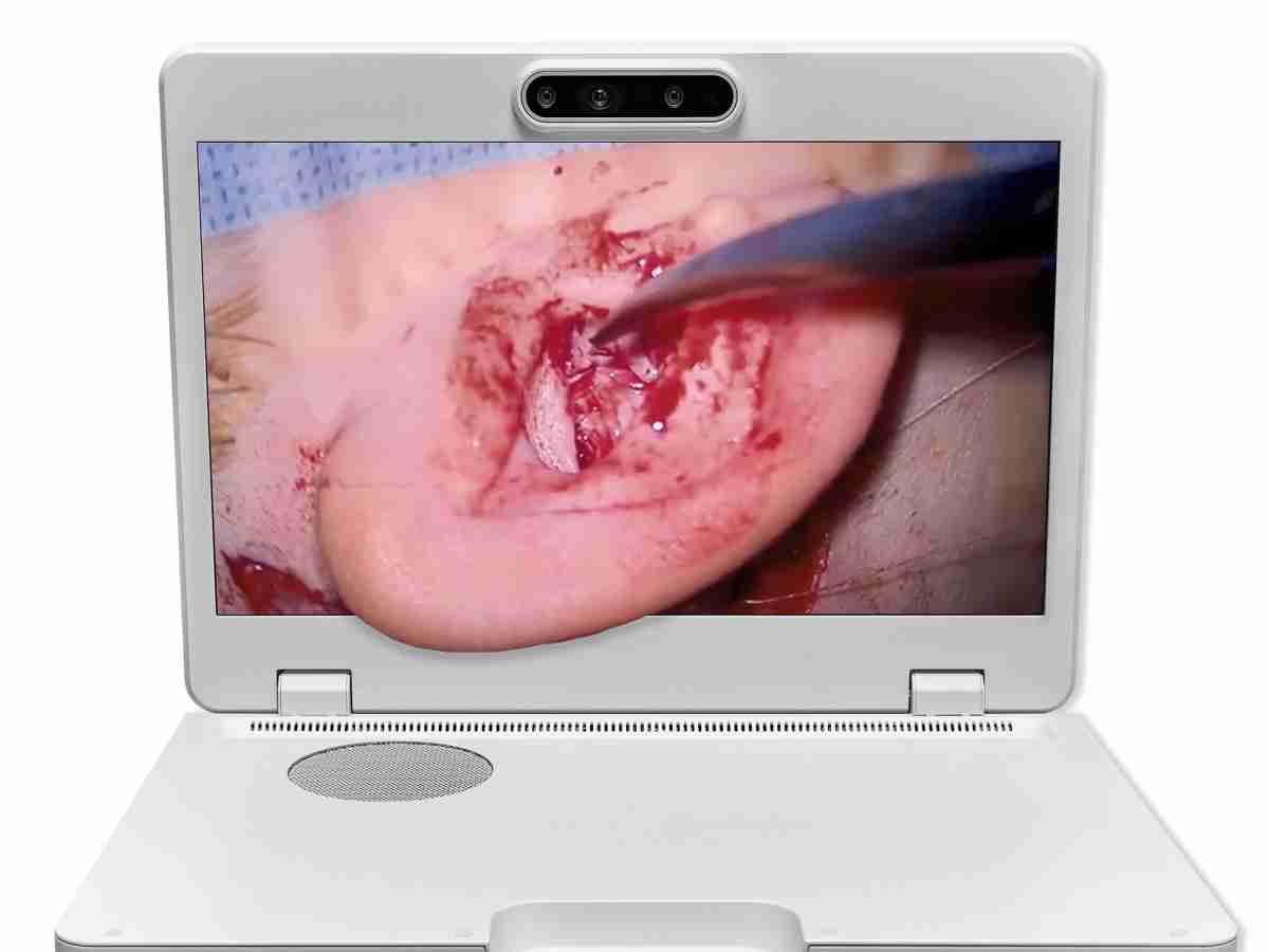 达擎之＂Heads-up 3D显微手术显示系统＂，，整合4K裸眼3D显示及眼球追踪系统，，，，具备快速追踪人眼移动位置功能，，，减轻医师长时间维持固定姿势的负担，，让医师能有更宽广清晰的3D立体视野及更舒适的姿势来执行手术。。。。